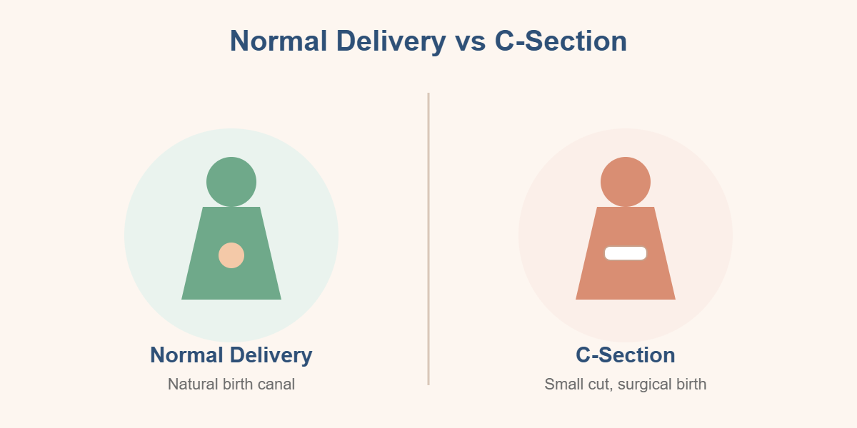 Normal delivery versus C-Section illustration